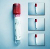 10ml blood collection pain tube