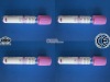 2ml vacuum blood tube