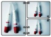 5ml blood collection pain tube