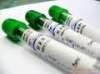 5ml vacuum blood collection tube