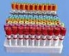 6ml vacuum blood collection tube